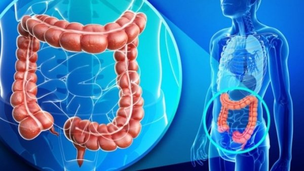 Кишечник может предупреждать человека о раке на ранней стадии